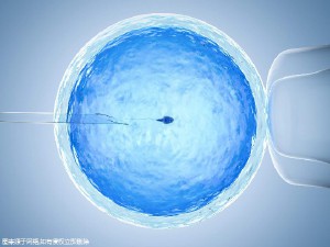 关于极光